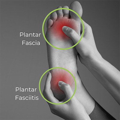 Chiropractic Winnipeg MB Plantar Fasciitis Pain